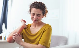 Common eczema myths